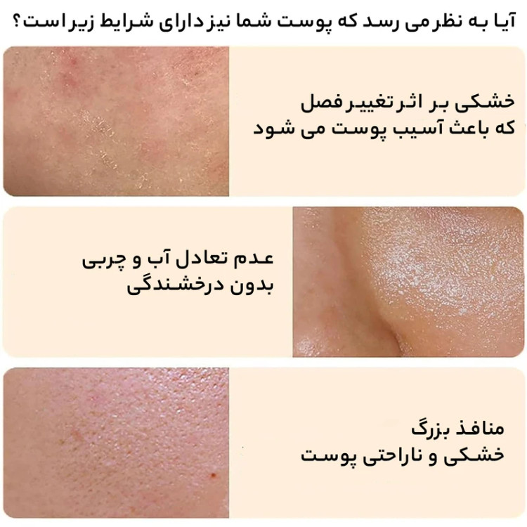 اسکراب لایه بردار پوست برنج بیوآکوا